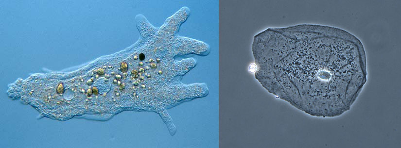 amoeba proteus versus human cheek cell