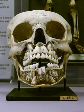 second set of teeth