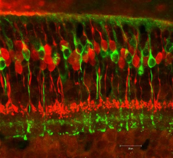 These are cone bipolar and rod bipolar cells in the fovea of the eye
