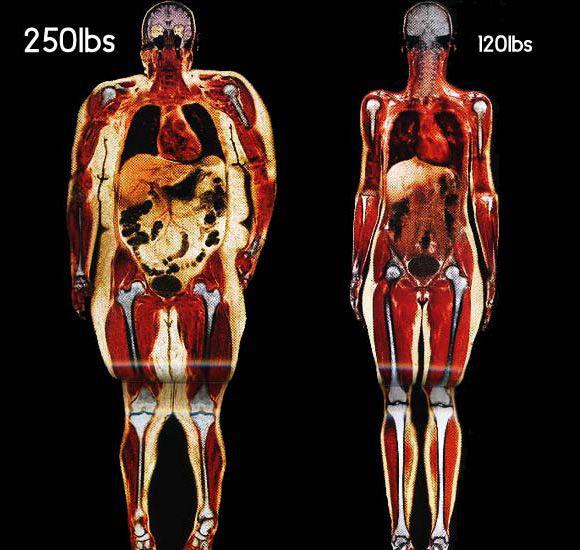 visceral-fat